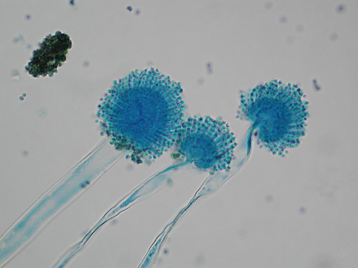 Aspergillus flavus